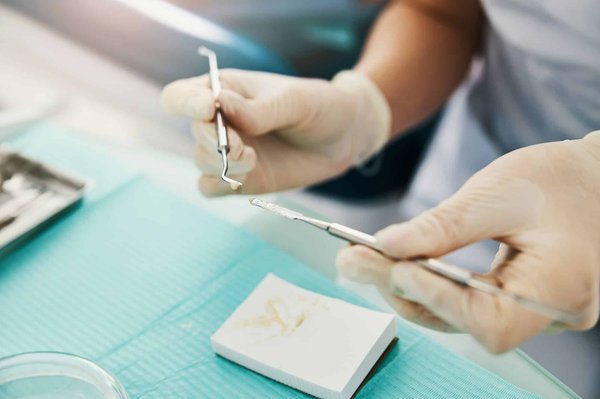 Quelle est la durée de vie d'un plombage dentaire à Mascouche ?